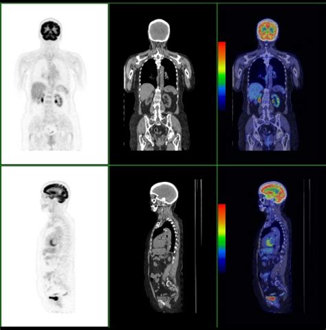 pet scan the villages fl|Radiology Services .
